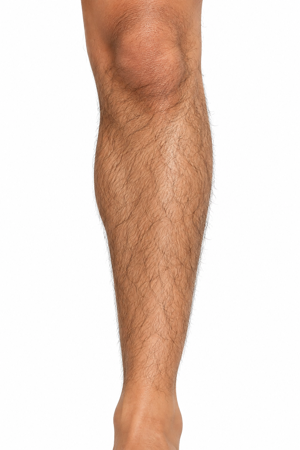 Skin before using Cool Hair Remover Gel
